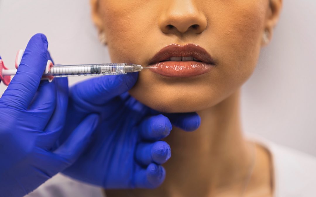 Lip Fillers in Canyon Lake & New Braunfels | Natural, Subtle Lip Enhancement