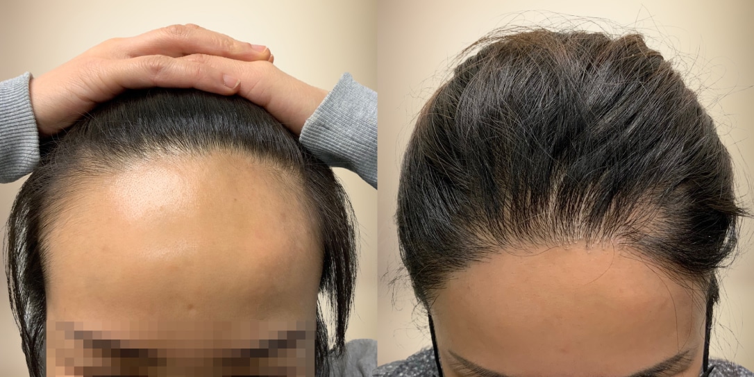 Before-After-04-1
