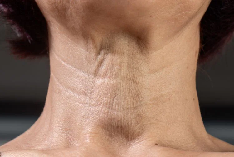 Neck Rejuvenation in New Braunfels: