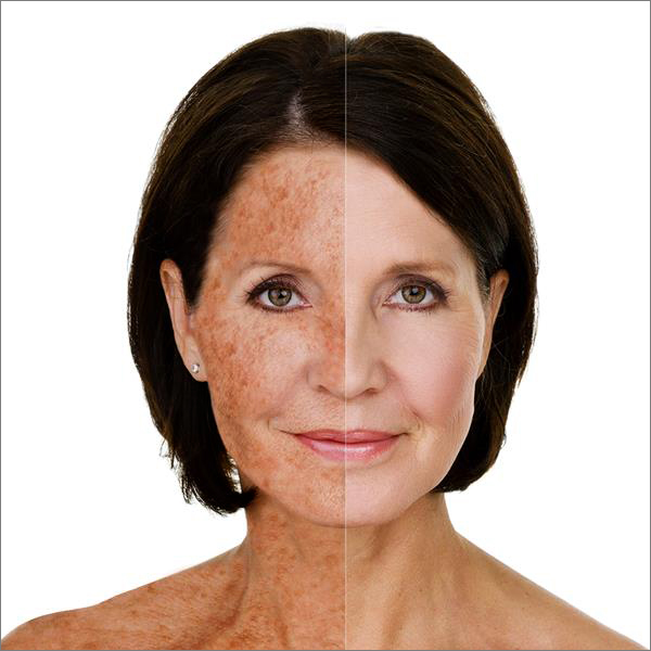 How to Get Rid of Sun Damage in Texas: Top Med Spa Treatments That Actually Work (Canyon Lake & New Braunfels)