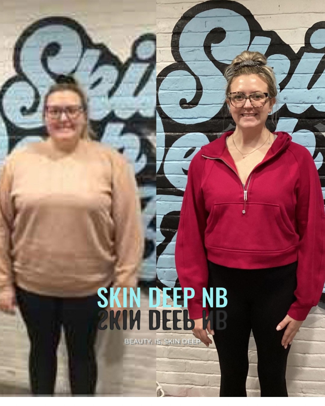 Semaglutide new braunfels Weight loss new braunfels , Weight loss Injection new braunfels