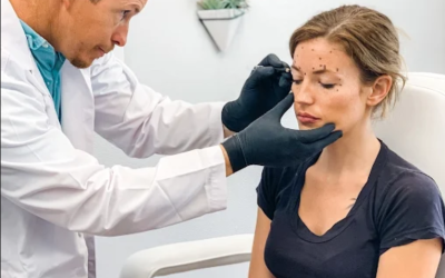 How to Choose the Right Skin Rejuvenation Treatment